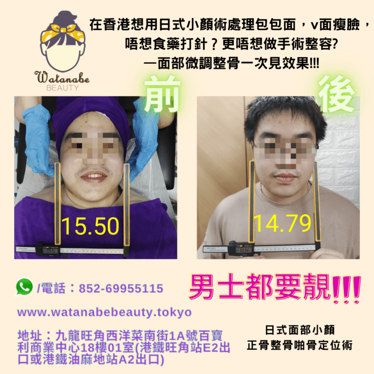 男士都要靚男子美容在香港想用日式小顏術處理包包面v面瘦臉唔想食藥打針更唔想做手術整容面部微調整骨一次見效果